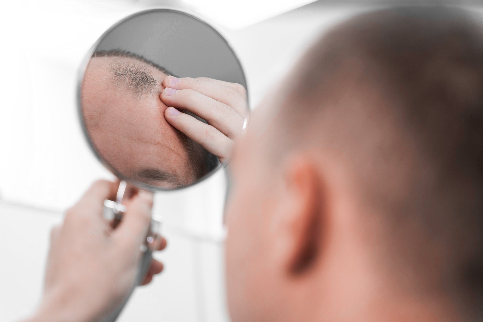 Especialista revisando el cuero cabelludo de un paciente con micro-cámara para diagnóstico de alopecia en Svenson Ecuador.